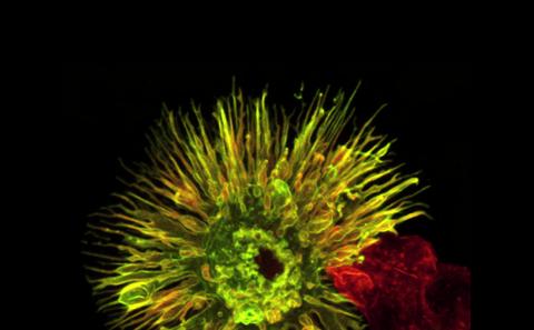 Globally, leukaemia accounts for some 300,000 new cases each year with 222,000 deaths